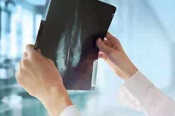 x-ray results for medical equipment financing