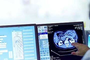 looking at brain scan at computer